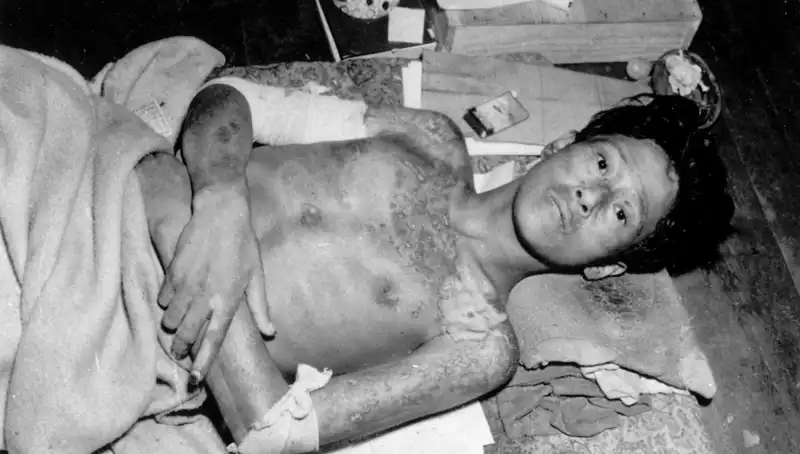 80 Yıl Sonra Nagasaki'den Gelen Uyarı: Nükleer Felaket Tehdidi Her Zamankinden Yakın